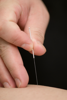 needling