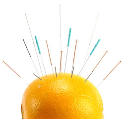 acupuncture needles in an orange