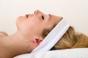Beautiful woman having acupuncture.