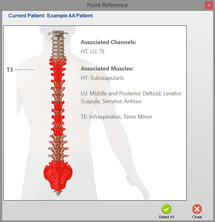 AcuGraph Spinal Graph example