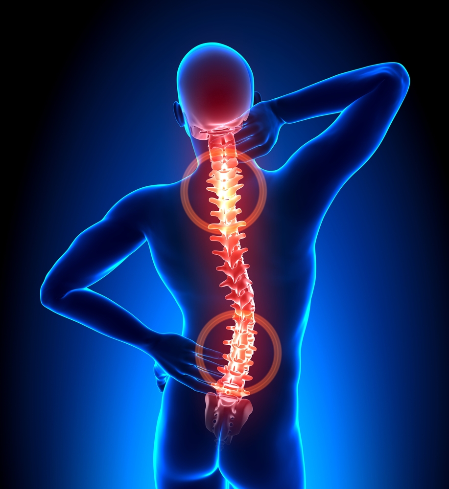 backpain3