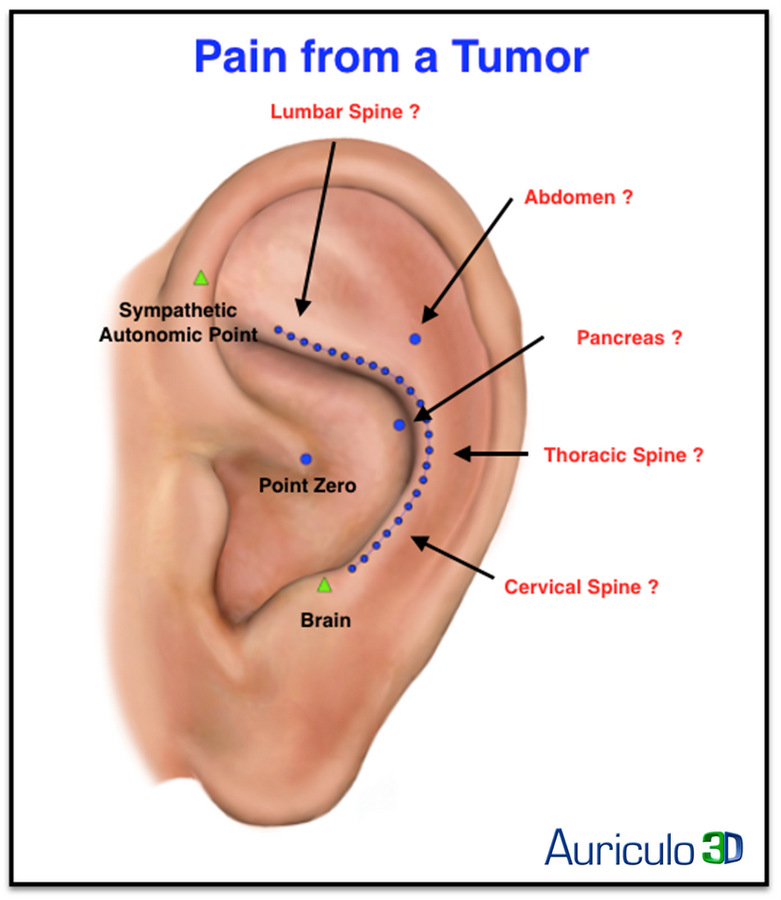 cancer of the stomach lymphoma