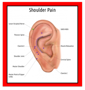 Shoulder Pain