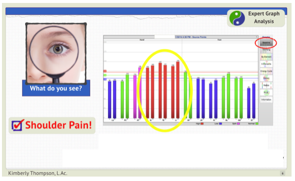Shoulder Pain