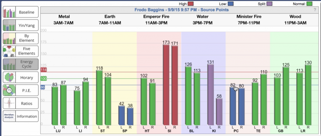 AcuGraph 5 Video Training: Graphs - Acupuncture Technology News