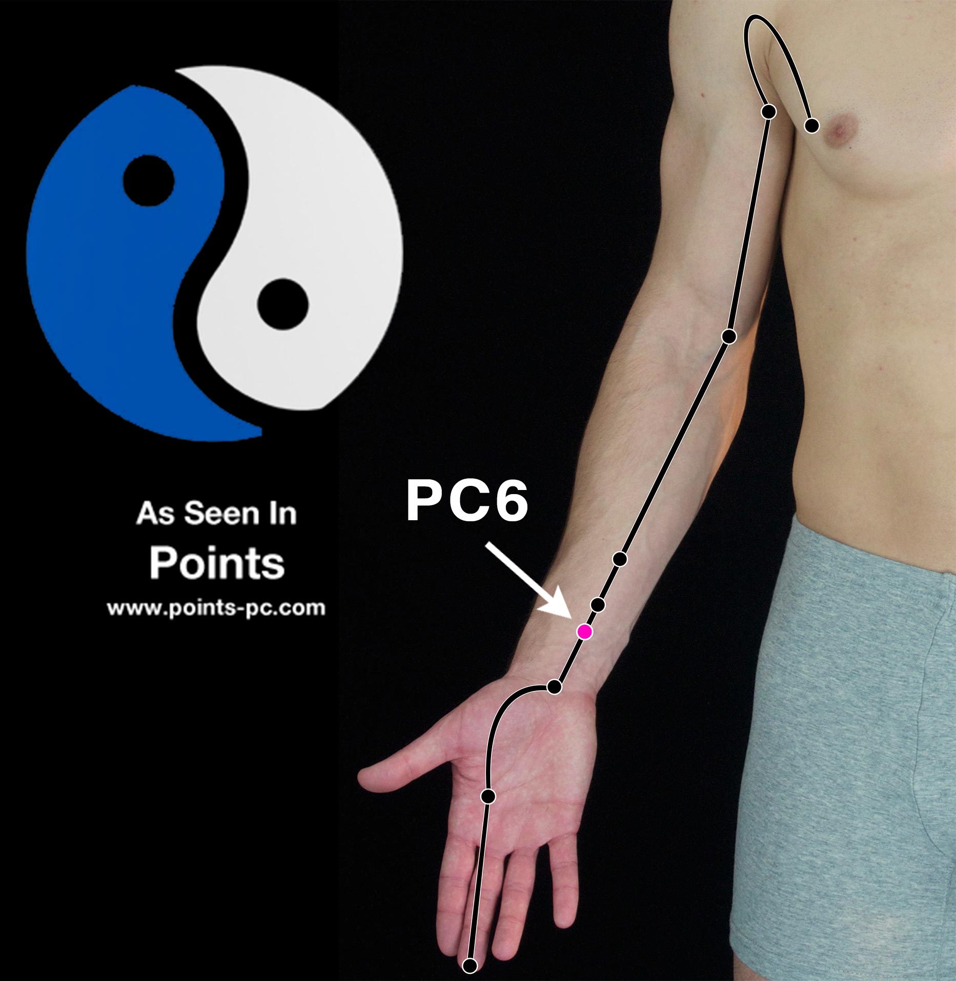 Acupuncture Point Pericardium 6 (PC 6) Acupuncture Technology News