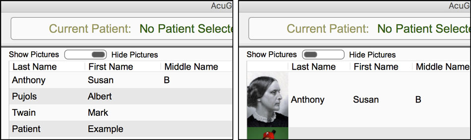 Turn on Patient Pictures in AcuGraph