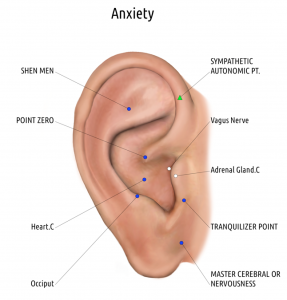 auriculotherapy anxiety