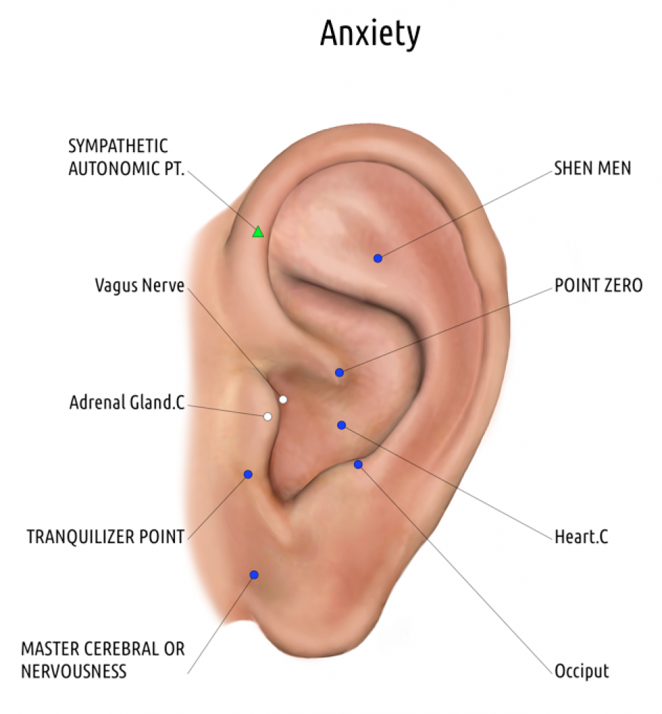 auriculotherapy anxiety auriculotherapy anxiety