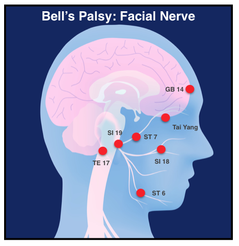 bell's palsy protocol
