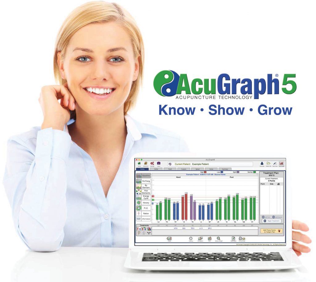 upgrade to AcuGraph 5