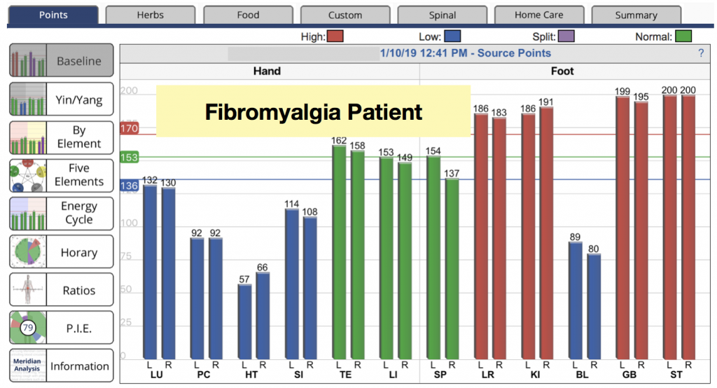 Fibromyalgia patient's graph
