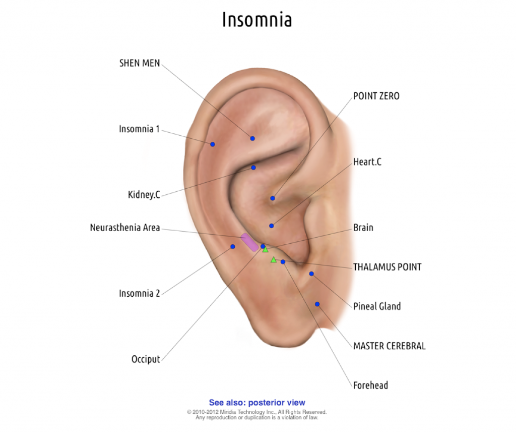 Auriculotherapy insomnia Protocol. Treat with the Stimplus Pro