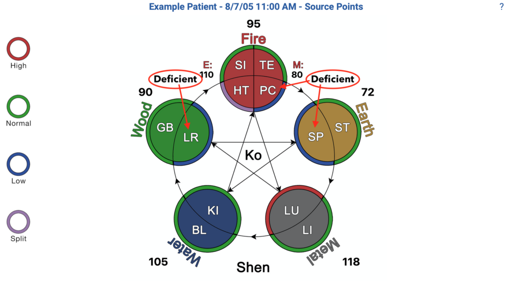 acupuncture meridians in the 5 Elements view 