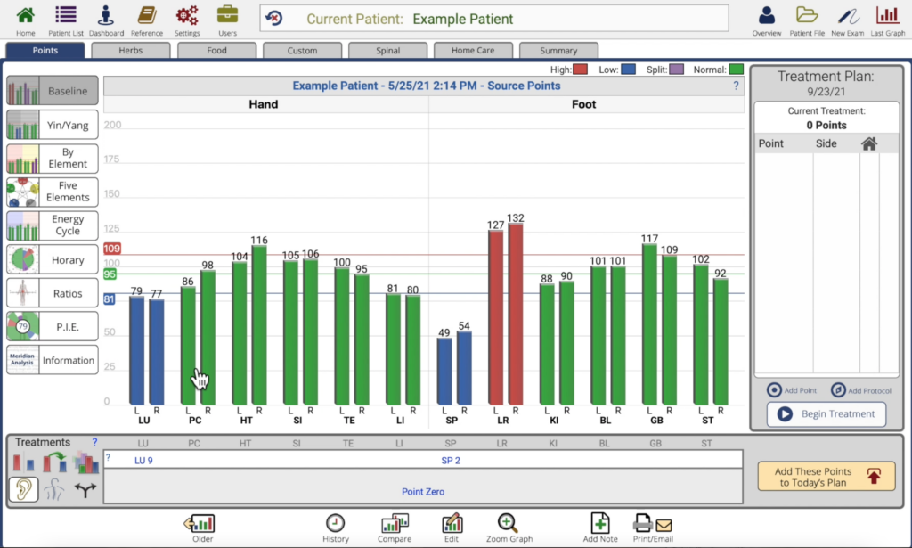 changing the measurement scale in AcuGraph